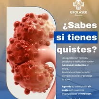 Uroláser Morelos 4